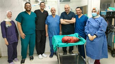 استئصال ورم يزن 18 كيلو جراما من معدة شاب بمركز أورام طنطا