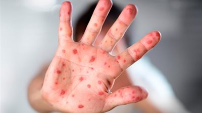 بمشاركة 12 دولة.. افتتاح الاجتماع الإقليمي الأول لشبكة الأوبئة لـ”الحمى القلاعية” (صور)