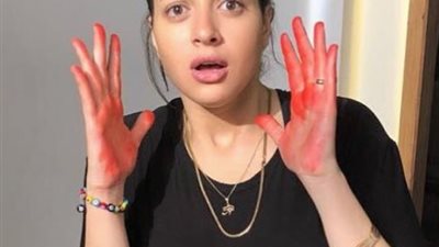 منى فاروق من دبي: “أنا تعبانه أووي”.. تفاصيل تدهور حالتها الصحية (صور)