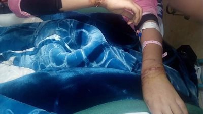 “التضامن” توجه بتقديم الدعم لطفلة عذبها والدها في الشرقية (صورة)