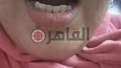 ننشر التقرير الطبي للاعتداء على سيدة حامل وزوجها داخل مستشفى التأمين الصحي بالإسكندرية (صور وفيديو)