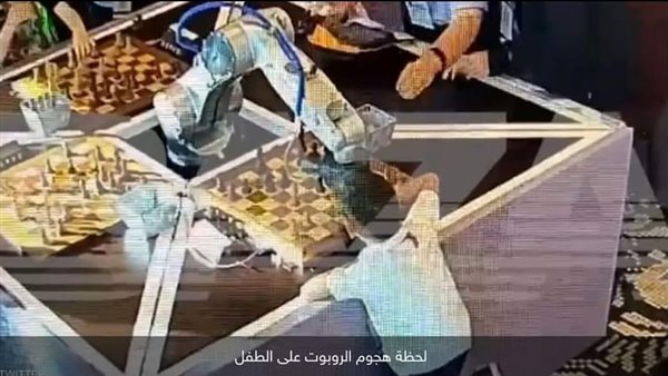 روبوت يكسر إصبع طفل