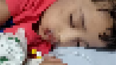 حرقت عضوه الذكري.. حبس زوجة ووالدتها لقيامهما بتعذيب ابن الزوج