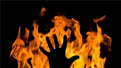 مصرع فتاة صغيرة بعد إشعال أسرة والدتها النار بمنزلها في عين شمس