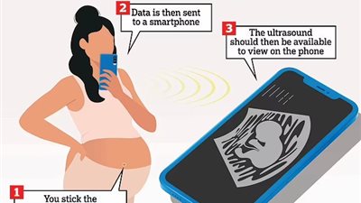 من خلال ملصقات.. الحوامل يشاهدن أطفالهن ينمون داخل أرحامهن على الهاتف المحمول قريبًا