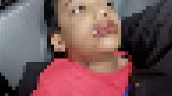 الطفل المعتدى عليه