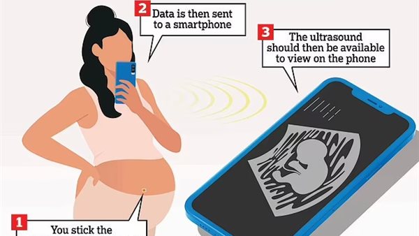 صورة تعبيرية