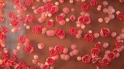 بعد تحذير أمريكي من مرض الراعوم.. تعرف على الأعراض وطرق الوقاية