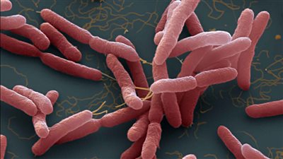 مميت ويهدد حياة البشرية.. تخوف من انتشار مرض الراعوم في مصر بعد ظهوره بأمريكا | بث مباشر