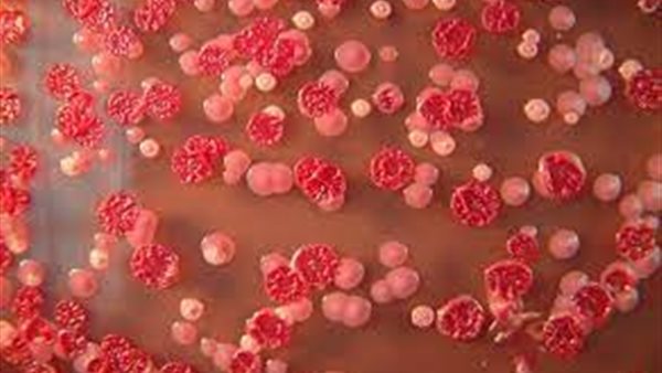 مرض الراعوم