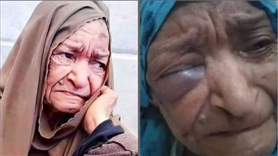حقيقة التعدي على عجوز داخل دار بسمة للإيواء بالشرقية | خاص