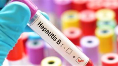 بعد انتشار الخطر في آسيا.. باكستان تقتدي بحملة 100 مليون صحة لمكافحة التهاب الكبد