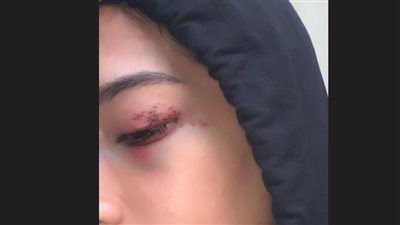 إخلاء سبيل المتهم بالتعدي على فتاة المعادي 