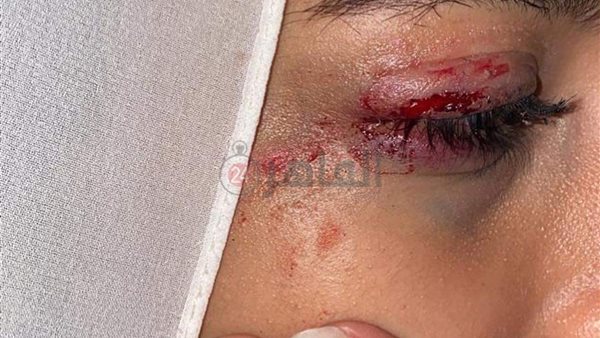 المجني عليها