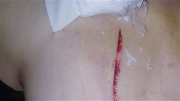 مسجلين خطر يعتدون