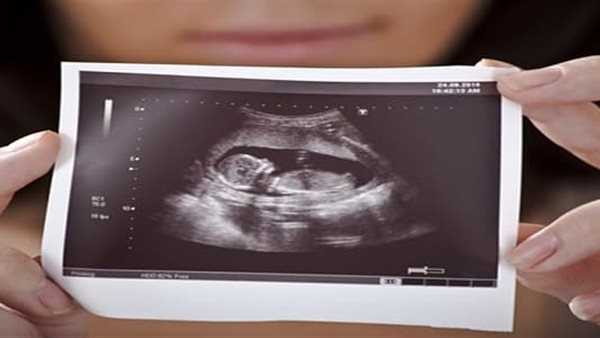 الكشف عن الجنين