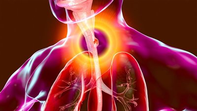 أبرزها بحة الصوت.. تعرف على بعض أعراض سرطان المريء