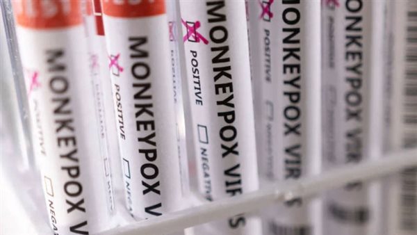 جدري القرود 