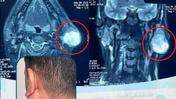 جراحات الوجه والفكين