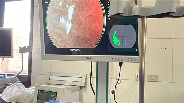 فريق طبي ينجح في