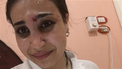 تتأخر خارج المنزل.. الداخلية تكشف ملابسات تعرض فتاة للعنف الأسري في الدقهلية