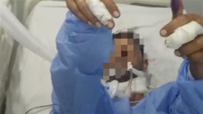 مذبوح بجرح قطعي طوله ربع متر.. أطباء مستشفى الدلنجات بالبحيرة ينقذون مواطنًا من الموت
