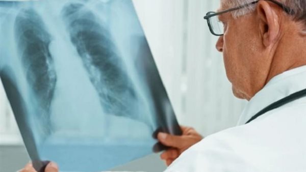 ظهور مرض غامض في