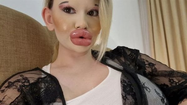 صاحبة أكبر شفاه في