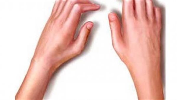 الروماتيزوم 