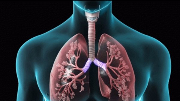 الانسداد الرئوي المزمن