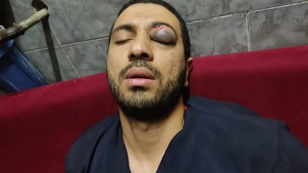 التعدي على فنى أشعه