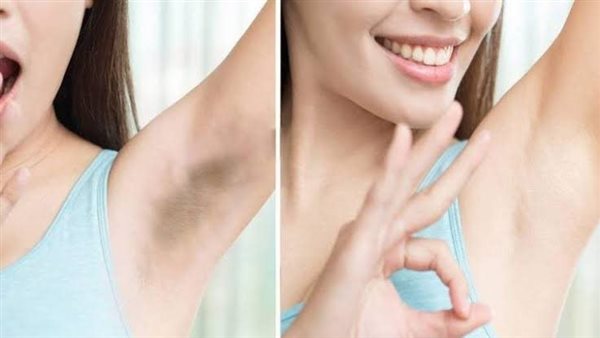 وصفات تفتيح المناطق