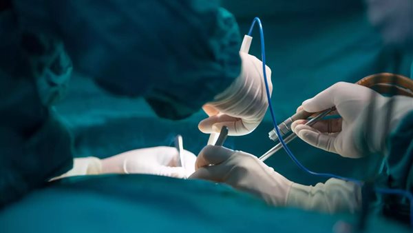 عمليه جراحية