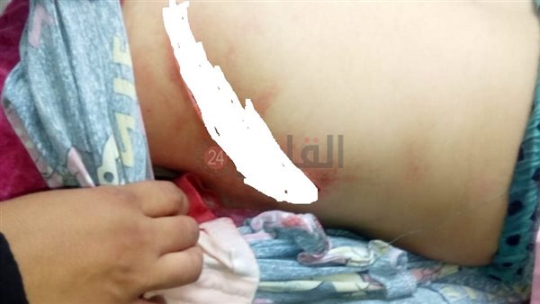 إصابة المجني عليه