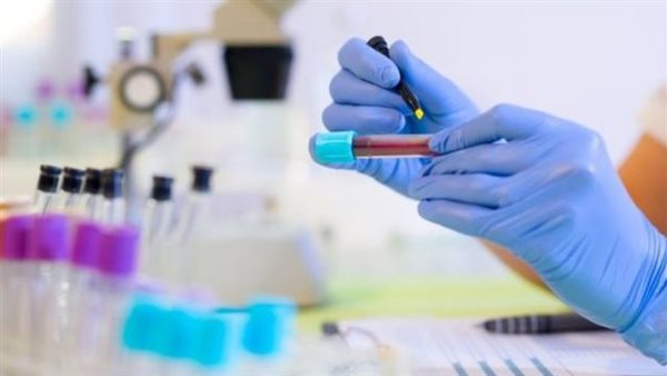 صورة تعبيرية 