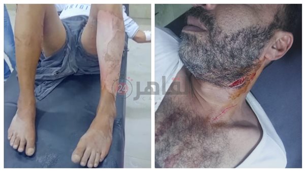 المجني عليهما 