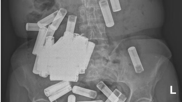 العثور على 55 بطارية