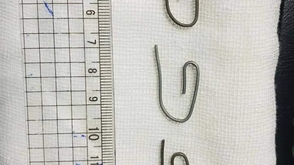 جانب من الجراحة 