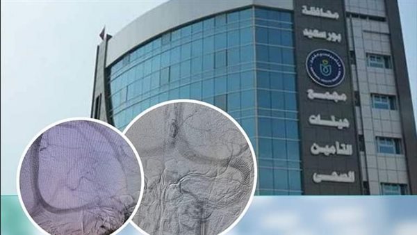 القسطرة المخية 