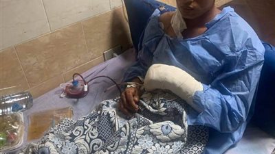 شقيقة عامل أصيب بجروح بالوجه والجسد استلزمت 100 غرزة بالقليوبية: عايزة حق أخويا وسرعة ضبط المتهم
