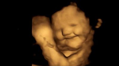 الأطفال في الرحم يبتسمون عند تناول أمهاتهم للجزر أو الكرنب| دراسة