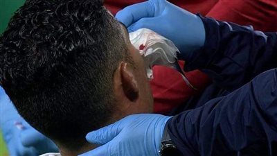 إصابة قوية لـ كريستيانو رونالدو خلال مباراة البرتغال والتشيك في دوري الأمم الأوروبية 