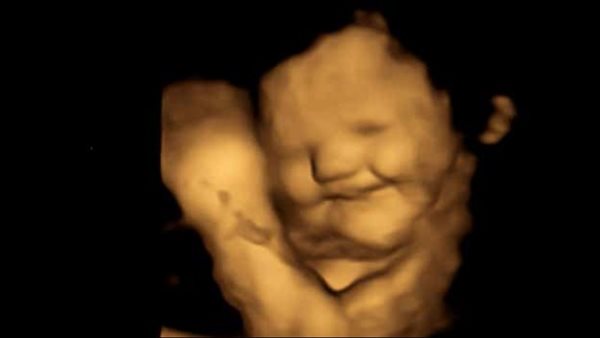 الأطفال يبتسمون عند