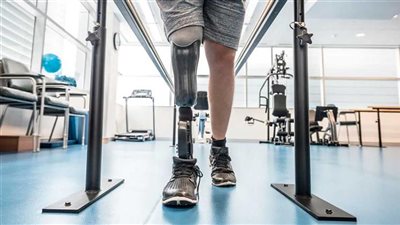 تمكنهم من المشي لـ 100 متر..الهند تطور ركبة اصطناعية لمبتوري الأطراف يمكن التحكم بها