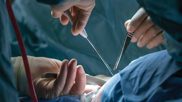 عمليات التبرع بالأعضاء