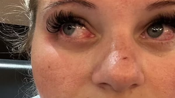  أليكسيس ثيريوت