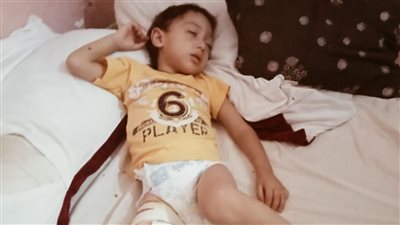 عاوزين نلحقه.. أسرة طفل مهدد ببتر ساقه: راقد على السرير بسبب صديد بياكل رجله