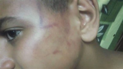 عذبه لمدة 3 ساعات بسلك المكوى بسبب 10 جنيهات.. حلاق يعتدي على طفل بالمحلة