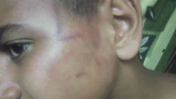 بلاغ يتهم حلاق بالتعدي