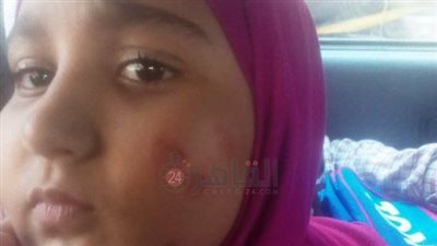ضربتها في عينها وشدّت شعرها.. ولية أمر تستغيث بعد ضرب ابنتها على يد مُعلمة في مدرسة بالجيزة